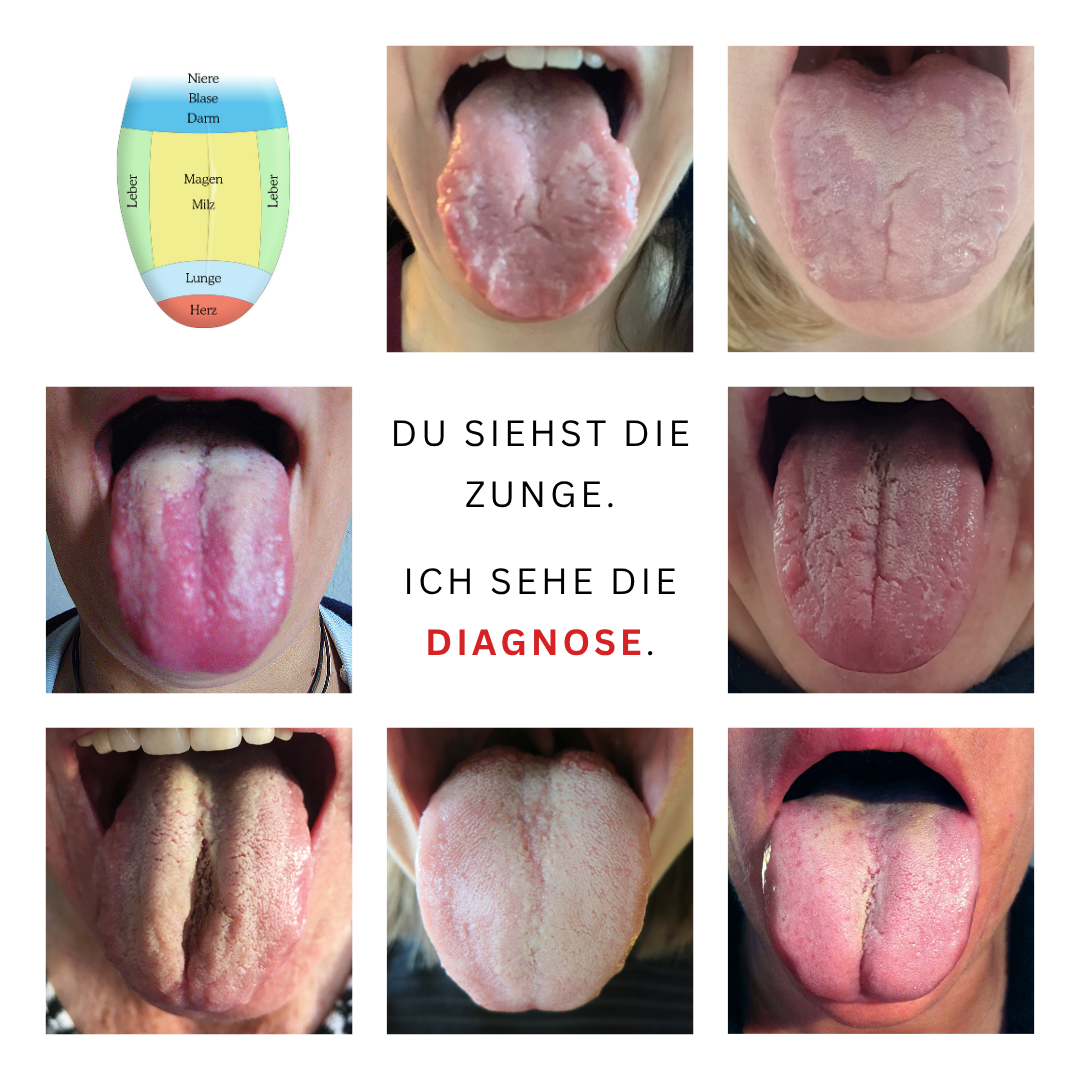 Zungen-Ad_14a Bild mir verschiedenen Zungen für Zungendiagnose-Kurs